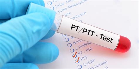 pt pihe|PT e PTT: quando eseguire questi esami del sangue